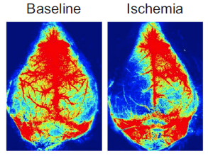 Typical images obtained in distal MCAO model (Wan et al 2022)