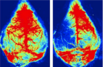 Laser Speckle Perfusion Imaging